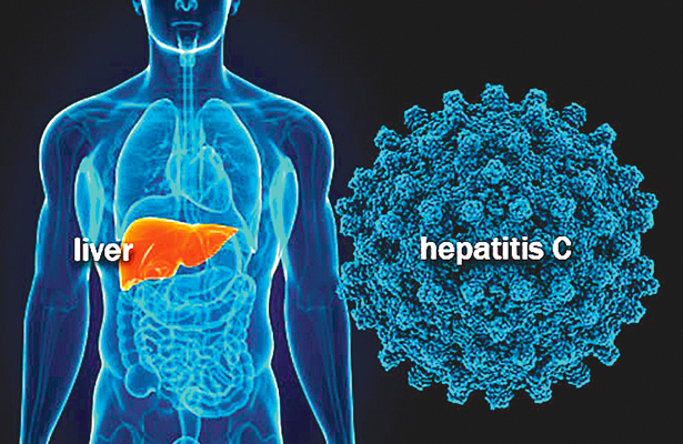 Web MD Only a small fraction of people can actually afford the full treatment for Hepatitis C.